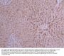 PCSK9 Recombinant Monoclonal Antibody