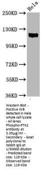 Phospho-PTK2 (Y397) Recombinant Monoclonal Antibody