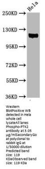 Phospho-PTK2 (Y397) Recombinant Monoclonal Antibody