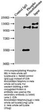 Phospho-RB1 (S780) Recombinant Monoclonal Antibody