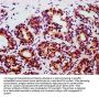 Phospho-STAT3 (Tyr705) Recombinant Monoclonal Antibody