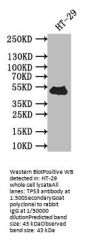 TP53 Recombinant Monoclonal Antibody