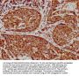 VDAC1 Recombinant Monoclonal Antibody