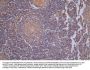 VIM Recombinant Monoclonal Antibody
