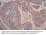 VIM Recombinant Monoclonal Antibody