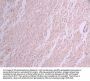 NEFM Recombinant Monoclonal Antibody