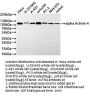 ACTN4 Recombinant Monoclonal Antibody