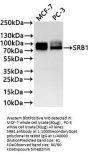 SCARB1 Recombinant Monoclonal Antibody