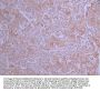 SCARB1 Recombinant Monoclonal Antibody