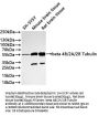 TUBB4B/TUBB2A/TUBB2B Recombinant Monoclonal Antibody