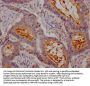 CEACAM1 Recombinant Monoclonal Antibody
