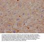 CEACAM1 Recombinant Monoclonal Antibody