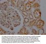 SIRT5 Recombinant Monoclonal Antibody