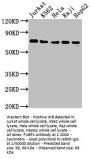 FUBP1 Recombinant Monoclonal Antibody