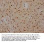 FUBP1 Recombinant Monoclonal Antibody