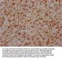 FUBP1 Recombinant Monoclonal Antibody
