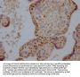 DNMT1 Recombinant Monoclonal Antibody