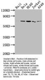 PRMT5 Recombinant Monoclonal Antibody