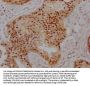 PRMT5 Recombinant Monoclonal Antibody