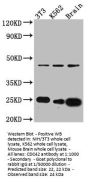 CDC42 Recombinant Monoclonal Antibody