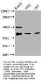NKX2-1 Recombinant Monoclonal Antibody