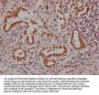 NKX2-1 Recombinant Monoclonal Antibody