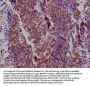 NKX2-1 Recombinant Monoclonal Antibody