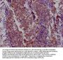 NKX2-1 Recombinant Monoclonal Antibody