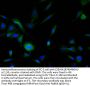 TH Recombinant Monoclonal Antibody