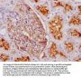 MME Recombinant Monoclonal Antibody