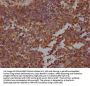 STAT3 Recombinant Monoclonal Antibody