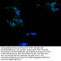 CALB2 Recombinant Monoclonal Antibody