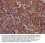 PTK2 Recombinant Monoclonal Antibody