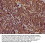 PTK2 Recombinant Monoclonal Antibody