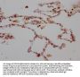 ALOX5 Recombinant Monoclonal Antibody