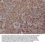 ALOX5 Recombinant Monoclonal Antibody