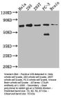 LTA4H Recombinant Monoclonal Antibody