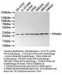 PRKN Recombinant Monoclonal Antibody