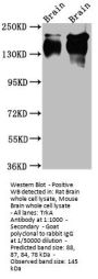 NTRK1 Recombinant Monoclonal Antibody