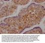 DDX58 Recombinant Monoclonal Antibody