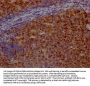 BIRC5 Recombinant Monoclonal Antibody
