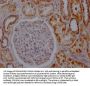 ACO2 Recombinant Monoclonal Antibody