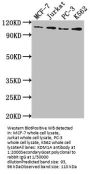 KDM1A Recombinant Monoclonal Antibody