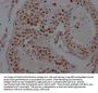 KDM1A Recombinant Monoclonal Antibody