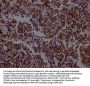 KDM1A Recombinant Monoclonal Antibody