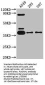 ADORA1 Recombinant Monoclonal Antibody