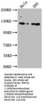 RNF20 Recombinant Monoclonal Antibody