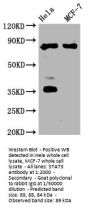 STAT3 Recombinant Monoclonal Antibody