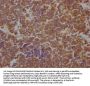STAT3 Recombinant Monoclonal Antibody