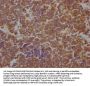 STAT3 Recombinant Monoclonal Antibody